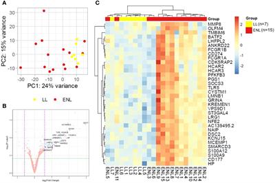 Whole blood transcriptomics reveals the enrichment of neutrophil activation pathways during erythema nodosum leprosum reaction